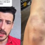 Thiago Schutz was released from prison after reporting an attack on his girlfriend; The victim’s defense refers to kicks and attempted rape