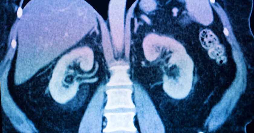 kudupinter – Scientists make alarming discovery about health impact of drinking bottled water — heres what you need to know