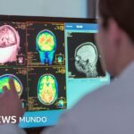 Adolescence lasts until age 32, according to a new study (and what other key ages for the brain)