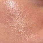 Oily skin? A dermatologist tells us what your skin care routine should look like