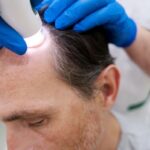 Non-surgical clinical treatments stimulate hair growth