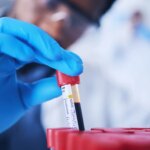 They discovered an extremely rare hybrid blood type in only 3 people