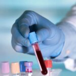 New antibody therapy eradicates multiple myeloma in 18 patients