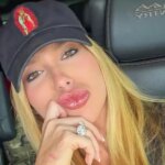 Grande Rio drum queen Virgínia Fonseca reveals skin problems linked to Carnival