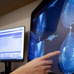 Artificial Intelligence predicts the risk of breast cancer 5 years earlier – 05/12/2025 – Equilibrio e Saúde