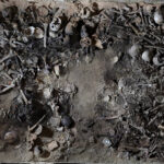 Bones hospitalized in Milan reveal 17th century diseases – 07/12/2025 – Science