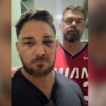 4c9ddcac-turista-e-tratado-como-lixo-diz-casal-agredido-em-porto-de-galinhas.jpg