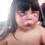 Her stepfather attacked her and was arrested