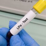 A third of Argentines suffer from high Lp(a), what is the risk and why do they ask to have it measured at least once in their life?