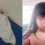 A man disfigured a 7-year-old girl’s face with beatings, attacked her mother and was arrested by neighbors in Gerli