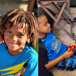 A 7-year-old boy had his legs amputated due to flu complications and is now asking everyone to get vaccinated