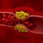 colesterol-alto-destaque.jpg