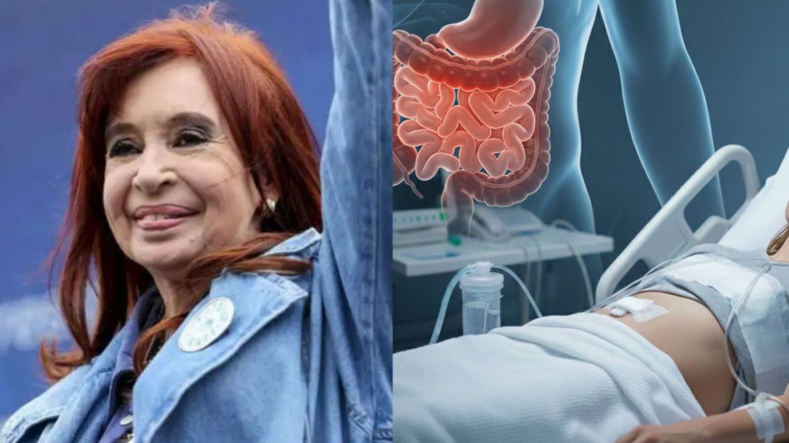 cristina-kirchner-y-el-ileo-posoperatorio-26122025-2160043.jpg