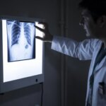 A disease that attacks bones and causes amputation in northern Kenya